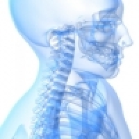 Radicular syndrome in the cervical spine area