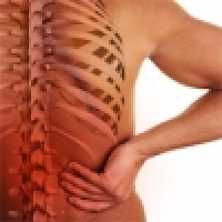 Blocked lumbar spine (Houser), Acute back pain, inflammation of the sitting nerve